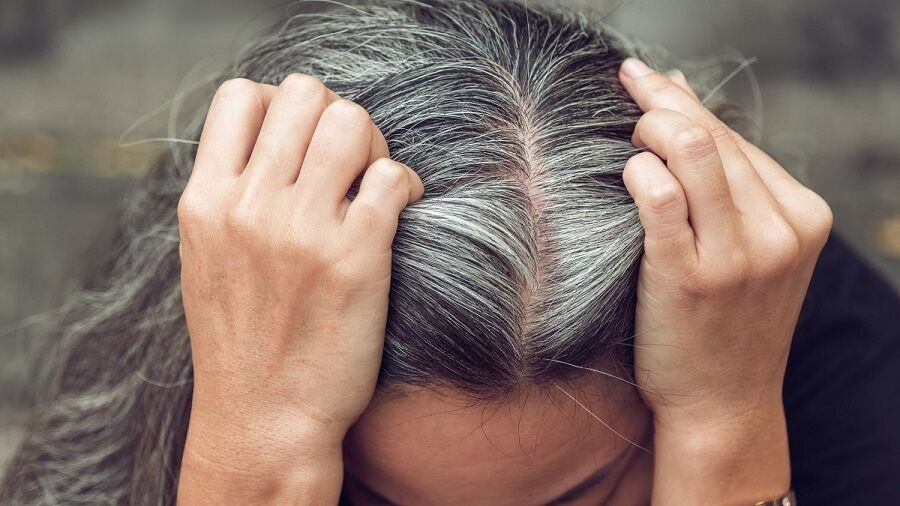آیا استرس واقعا عامل سفید شدن مو است؟ آیا استرس واقعا عامل سفید شدن مو است؟