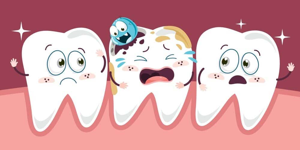 دندان پوسیده را چطور میتوان تشخیص داد؟ دندان پوسیده را چطور میتوان تشخیص داد؟