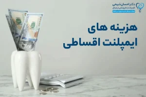 هزینه ایمپلنت دیجیتال در مازندران | جدیدترین قیمت 1404