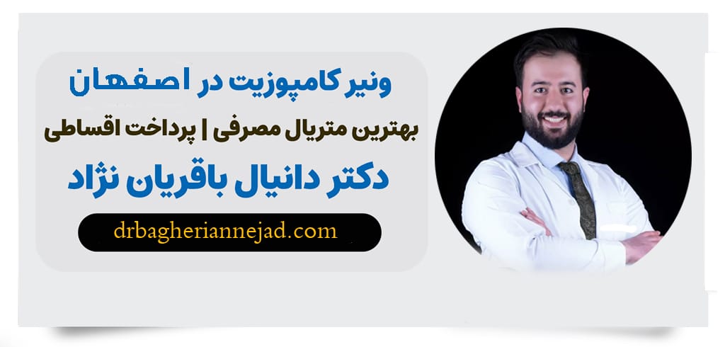 قبل از مراجعه به دندانپزشک زیبایی در اصفهان، این 5 نکته را از دست ندهید!