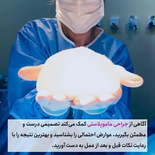 سوالات متداول پیش از انجام عمل ماموپلاستی