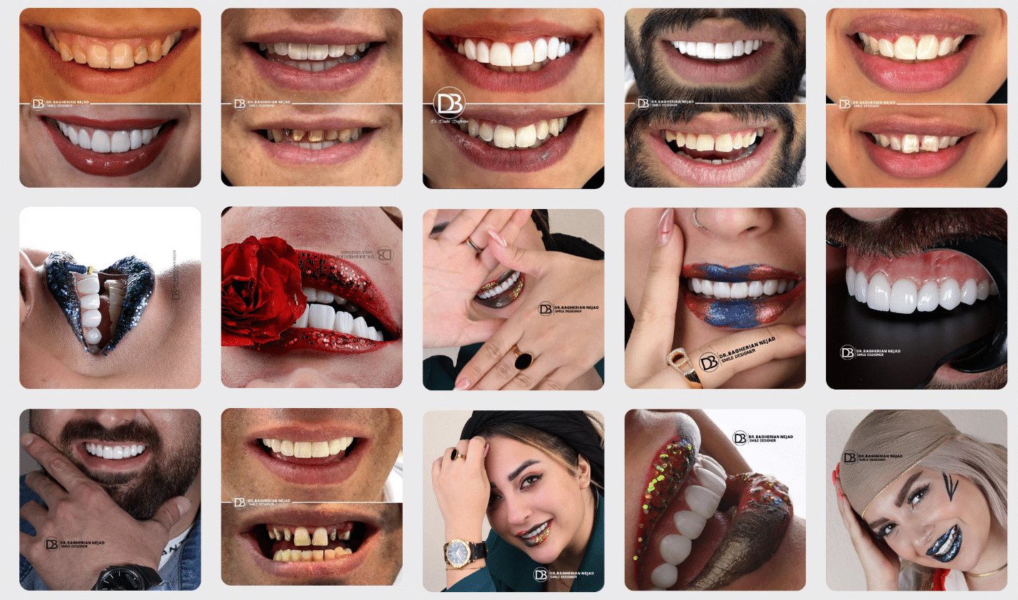 قبل از مراجعه به دندانپزشک زیبایی در اصفهان، این 5 نکته را از دست ندهید!