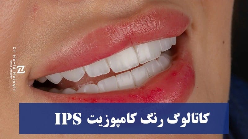 طیف رنگی کامپوزیت IPS : رنگ BLXL و رنگ bll