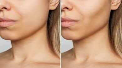 فواید دستگاه ایر کولینگ فواید دستگاه ایر کولینگ