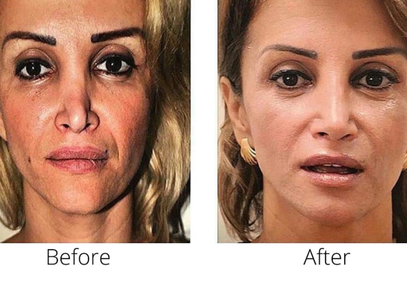 رازهای مهمی که برای انتخاب جراح عمل ترمیم بینی باید بدانید