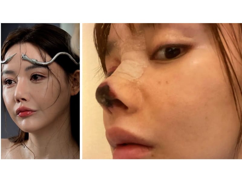 نمونه عمل بینی اولیه ناموفق