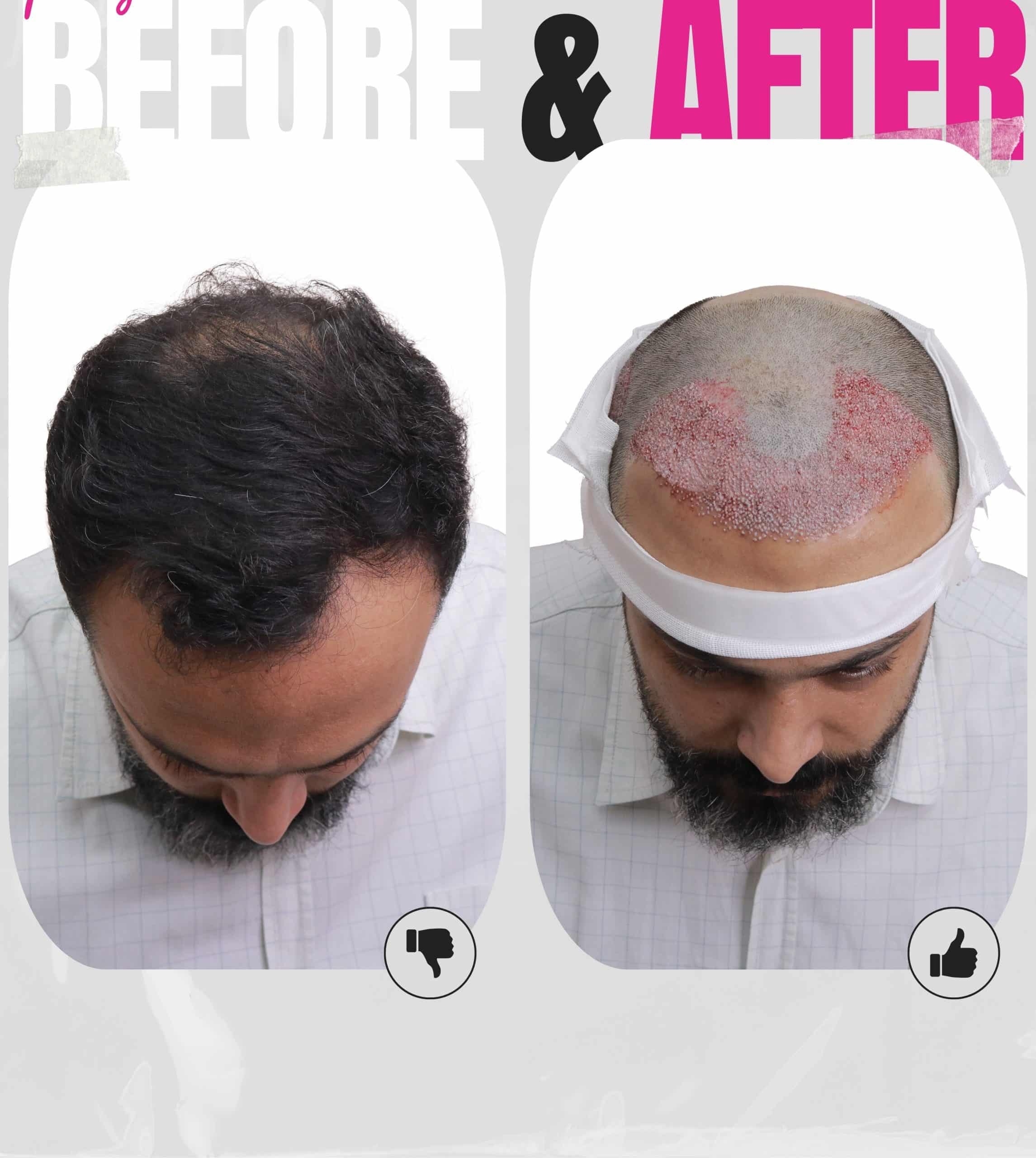 کلینیک کاشت مو در غرب تهران