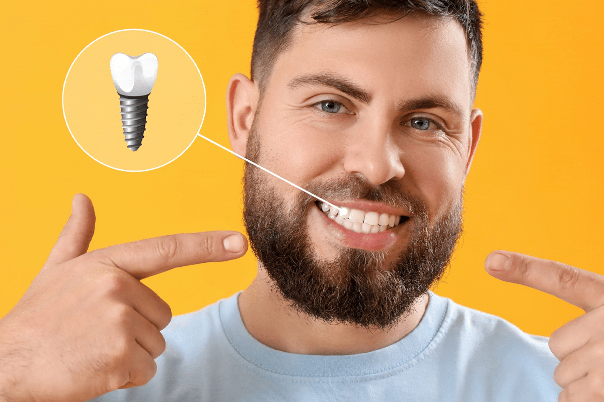 چرا انتخاب متخصص ایمپلنت با تجربه در تبریز میتواند 10 سال عمر ایمپلنت شما را افزایش دهد؟