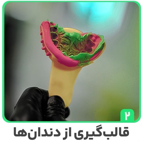 قالب گیری دندان برای ارتودنسی نامرئی