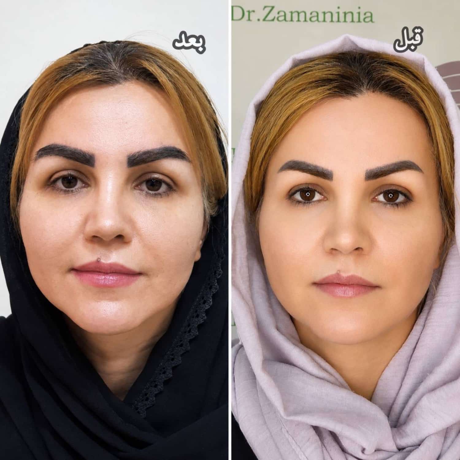 اگر از چین و چروک خسته شده اید، این راه حل را از دست ندهید