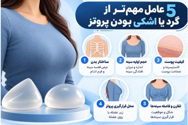 عوامل مهم پروتز سینه